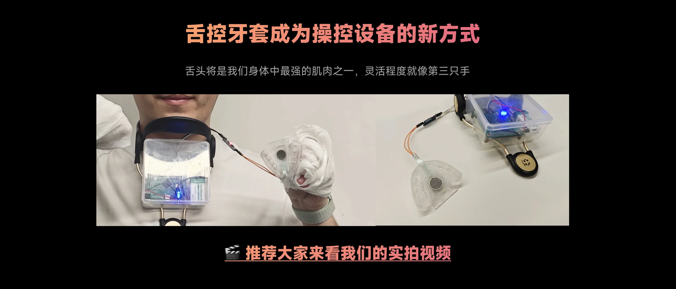 舌控牙套软硬件原型